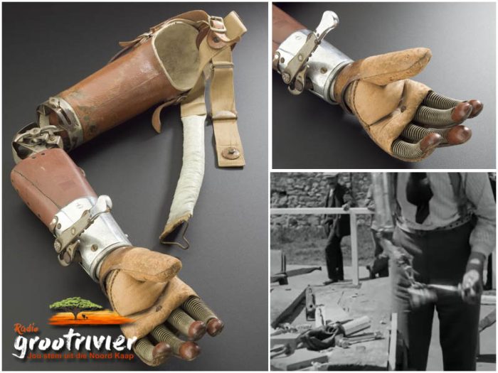 Die multifunksionele prostetiese arm uit die 1920s